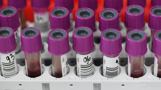 Bone marrow donor search in Russia